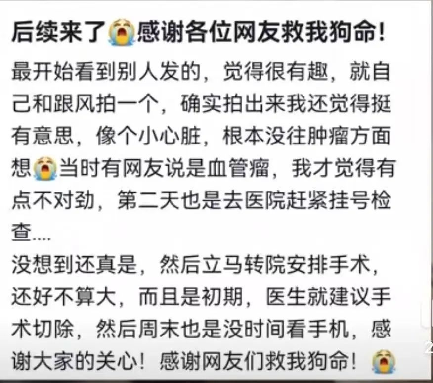 女生晒电筒照手图被网友发现不对劲!检查后确诊血管瘤立马住院手术,医生提醒 女生晒电筒照手图被网友发现不对劲!检查后确诊血管瘤立马住院手术,医生提醒