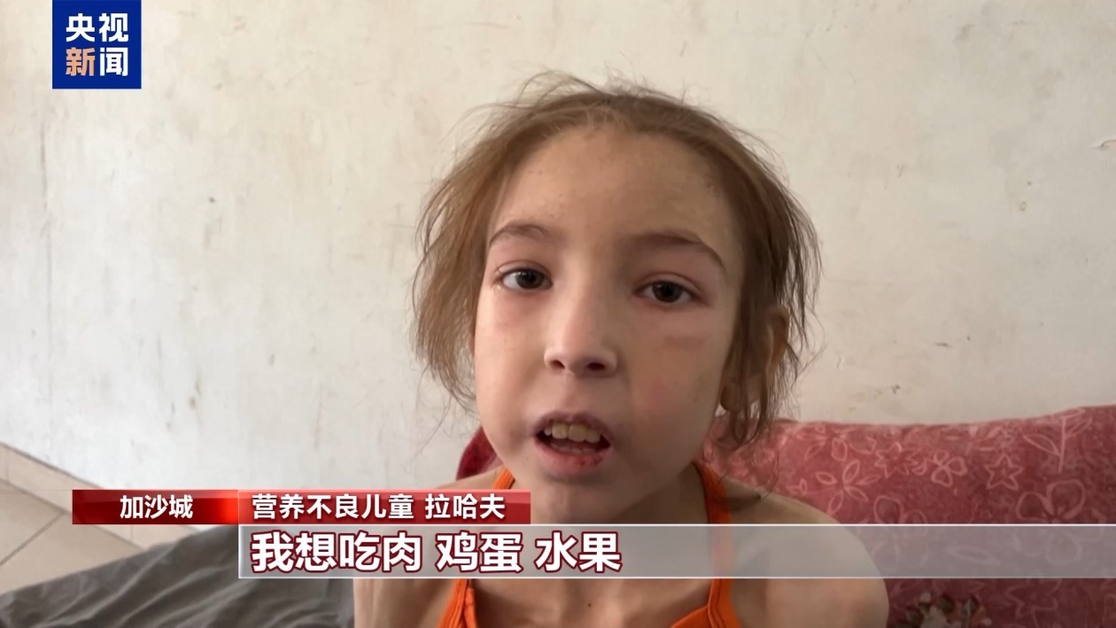 12岁女童仅重14公斤 以军封锁让加沙儿童面临极为危险处境 12岁女童仅重14公斤 以军封锁让加沙儿童面临极为危险处境