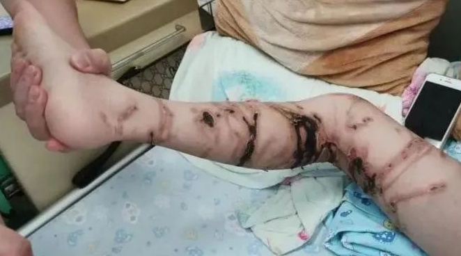 有毒!别碰! 有毒!别碰!