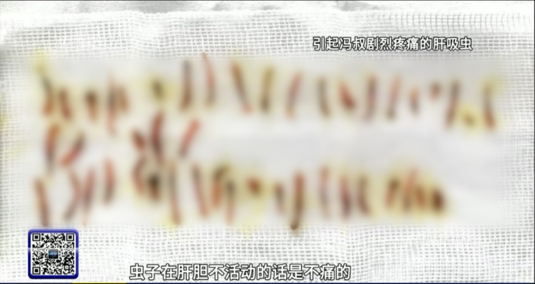 “始终还是中招了！”密密麻麻，广州阿叔在急诊科疼到受不了