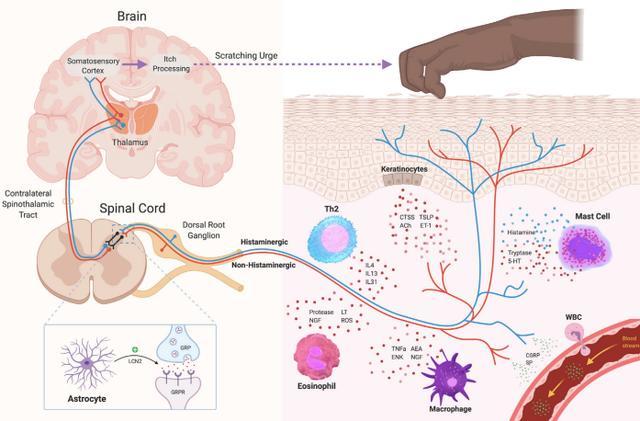 挠一挠确实可以止痒,但也会变得更痒!华人科学家揭秘人体为何会这 挠一挠确实可以止痒,但也会变得更痒!华人科学家揭秘人体为何会这
