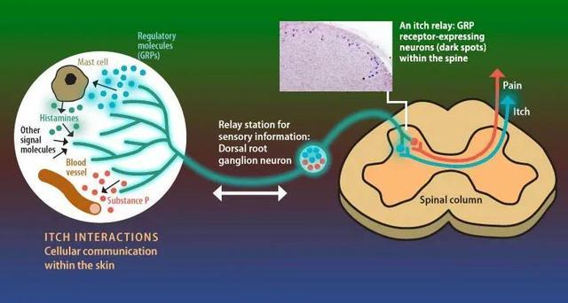 挠一挠确实可以止痒,但也会变得更痒!华人科学家揭秘人体为何会这 挠一挠确实可以止痒,但也会变得更痒!华人科学家揭秘人体为何会这