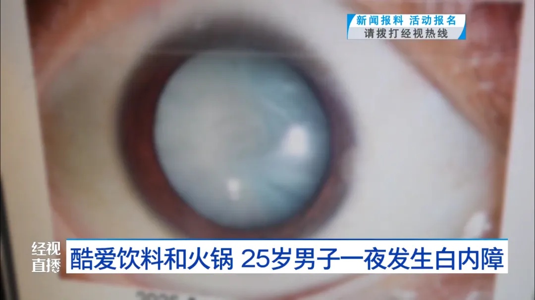 瞳孔中央全白了！25岁小伙一夜之间看不清！这些习惯很多人都有