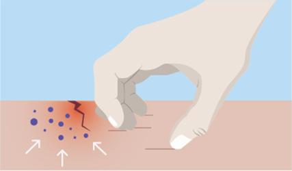 挠一挠确实可以止痒,但也会变得更痒!华人科学家揭秘人体为何会这 挠一挠确实可以止痒,但也会变得更痒!华人科学家揭秘人体为何会这