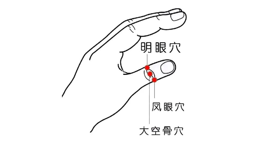 手上竟有恢复视力、通便的奇穴!适合所有人 手上竟有恢复视力、通便的奇穴!适合所有人