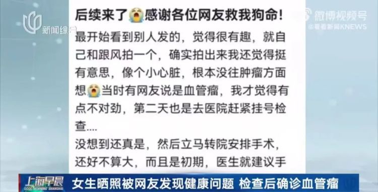 女生晒照被网友提醒有“瘤”？真的救命了！医生回应……
