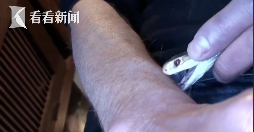 是个狠人！男子注射蛇毒18年，产生抗体…此前已截掉部分手指