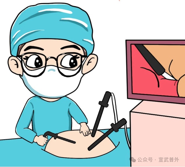 术前为什么要进行肠道准备？看完你就明白了！