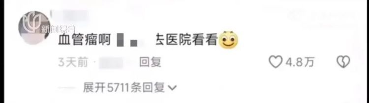 女生晒照被网友提醒有“瘤”？真的救命了！医生回应……