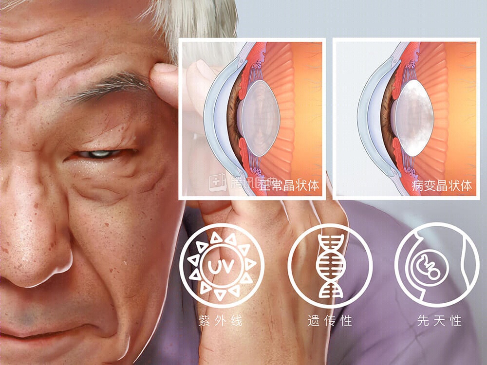 25岁小伙瞳孔一夜之间全白！平时爱吃喝这些……