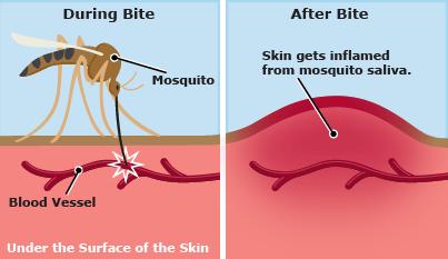 挠一挠确实可以止痒,但也会变得更痒!华人科学家揭秘人体为何会这 挠一挠确实可以止痒,但也会变得更痒!华人科学家揭秘人体为何会这
