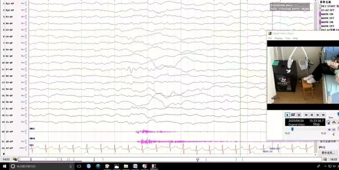 半夜猛然坐起!快速蹬腿、面露惊恐……6岁女孩反复发作,去了医院才知道竟是这问题 半夜猛然坐起!快速蹬腿、面露惊恐……6岁女孩反复发作,去了医院才知道竟是这问题