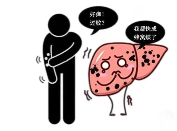 皮肤瘙痒，不是该洗澡了，竟和肝癌有关系！