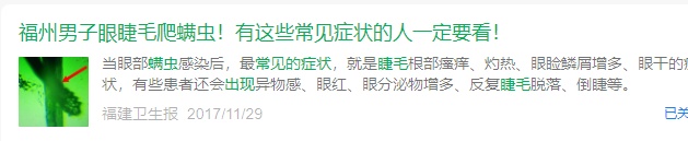 13岁男孩眼睛里住了80多只螨虫！医生提醒