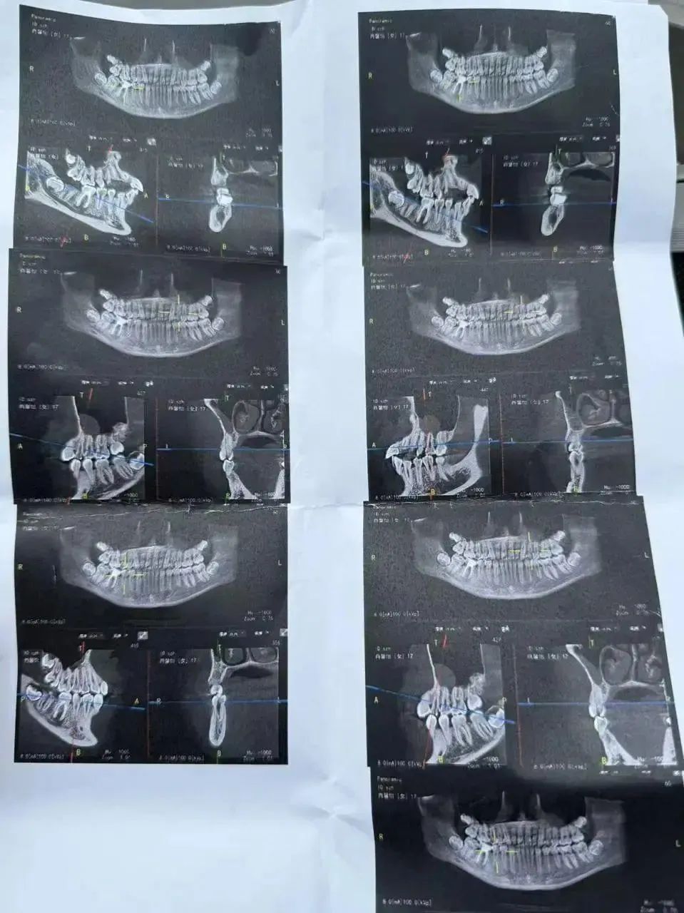 实习生晕倒摔断牙齿算不算工伤？医疗费用谁来付？