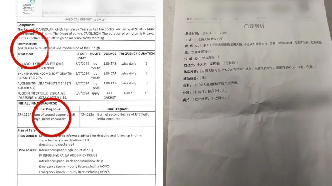 女子乘飞机被邻座碰倒热茶致大腿二级烫伤，航司否认存过错拒绝赔偿，阿联酋航空回应