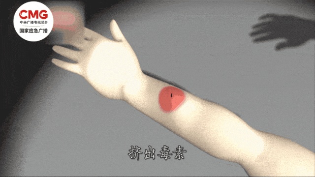 进入活跃期！4岁女童被叮咬后死亡，遇到它千万警惕