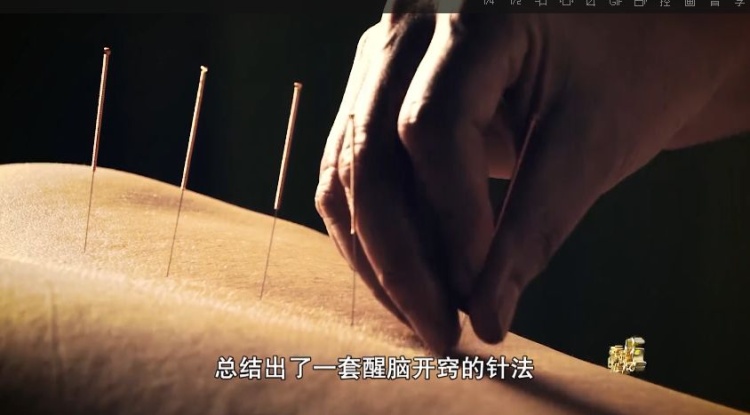 哀悼！国医大师石学敏逝世，享年86岁