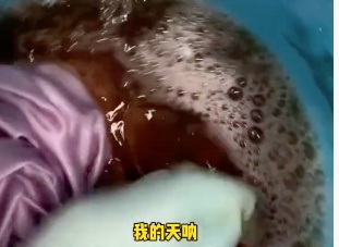 丈夫吸烟43年,结果妻子确诊肺癌!这种“烟”到底有多可怕 丈夫吸烟43年,结果妻子确诊肺癌!这种“烟”到底有多可怕