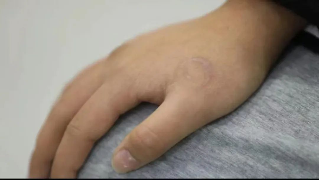 14岁少女隐瞒年龄自愿文身,店家可以免责吗?法院判了 14岁少女隐瞒年龄自愿文身,店家可以免责吗?法院判了