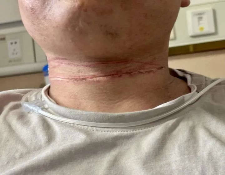 男子骑车遭“割喉”!近期多人遭殃 男子骑车遭“割喉”!近期多人遭殃