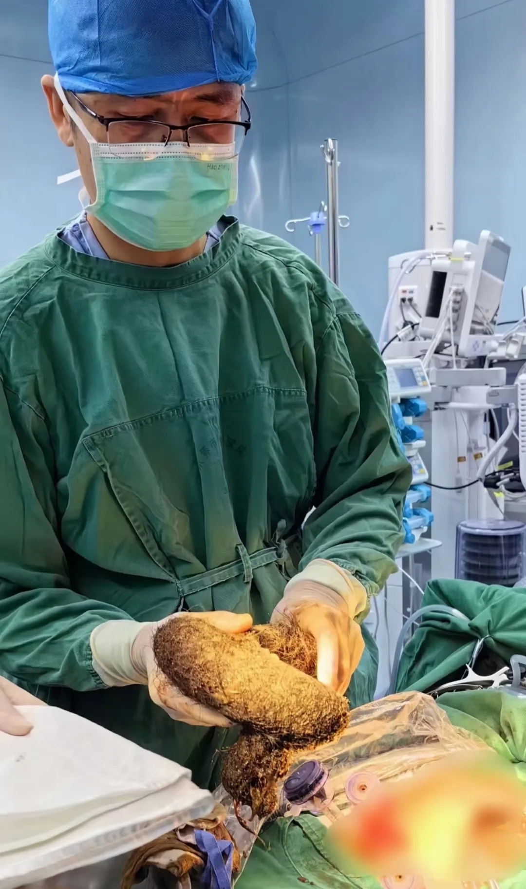 10岁女孩体内这一幕让医生惊呆了!有人因羞耻感延误就医,这种情况必须重视... 10岁女孩体内这一幕让医生惊呆了!有人因羞耻感延误就医,这种情况必须重视...