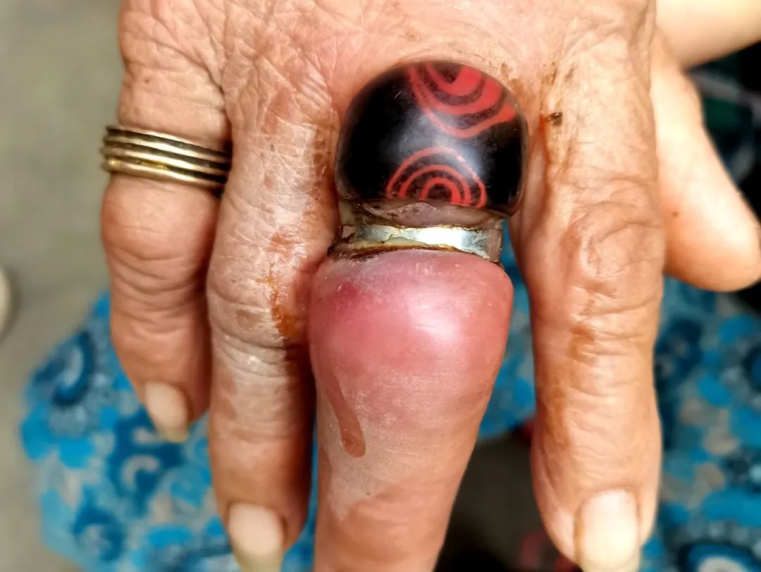 太痛苦!收到万元礼物后,杭州女子紧急求助:切了吧 太痛苦!收到万元礼物后,杭州女子紧急求助:切了吧