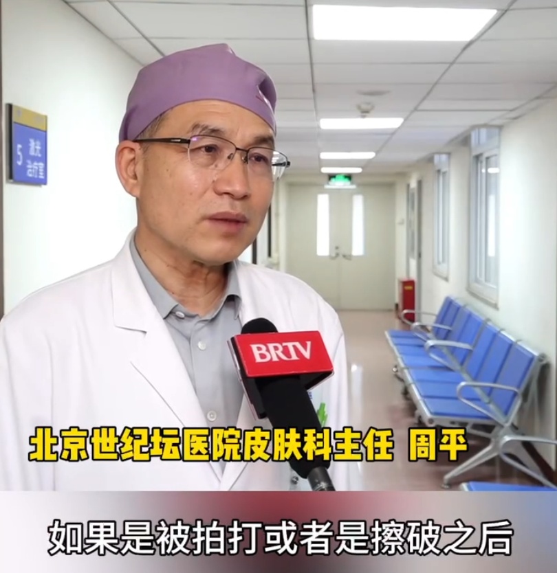 这种虫子提前进入活跃期,医生紧急提醒:千万别上手拍—— 这种虫子提前进入活跃期,医生紧急提醒:千万别上手拍——