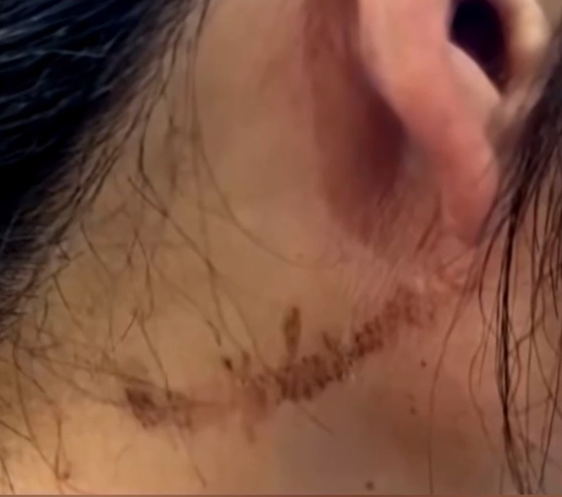 这种虫子提前进入活跃期,医生紧急提醒:千万别上手拍—— 这种虫子提前进入活跃期,医生紧急提醒:千万别上手拍——