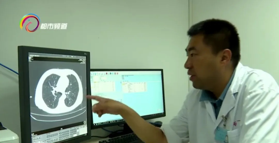 每天一包烟,血管成"危墙"!一台手术后解除心脏"危机" 每天一包烟,血管成"危墙"!一台手术后解除心脏"危机"