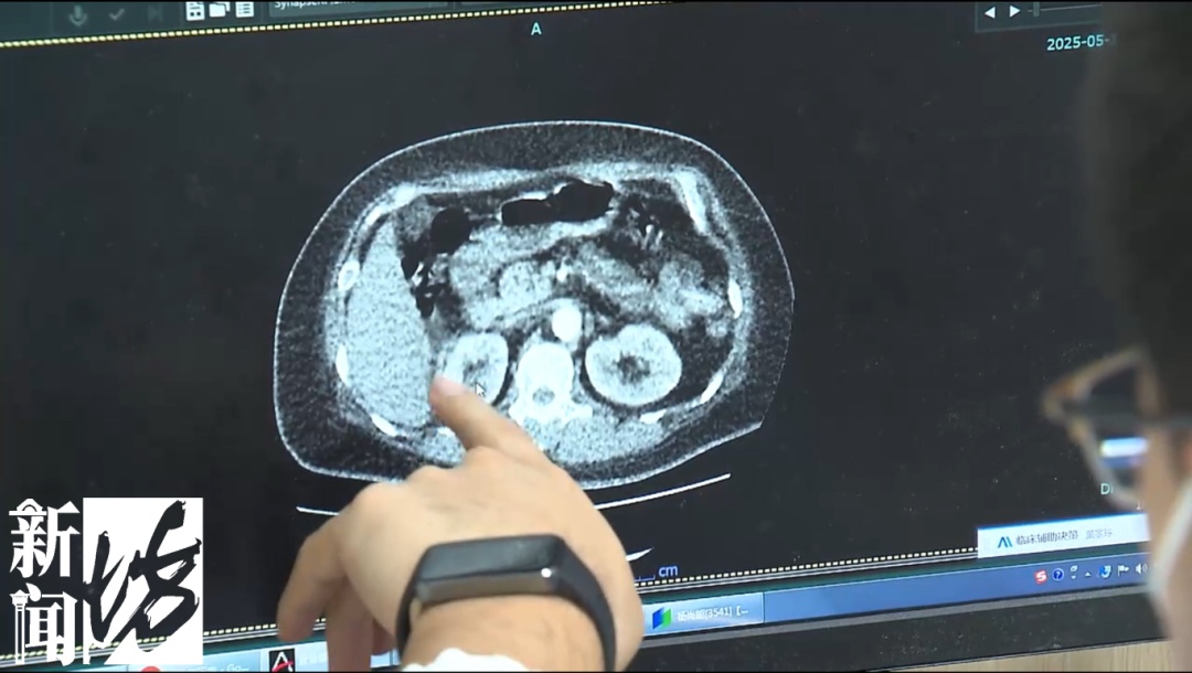 我国有近3亿患者,不少上海人最近却擅自停药!医生急了:可致猝死… 我国有近3亿患者,不少上海人最近却擅自停药!医生急了:可致猝死…