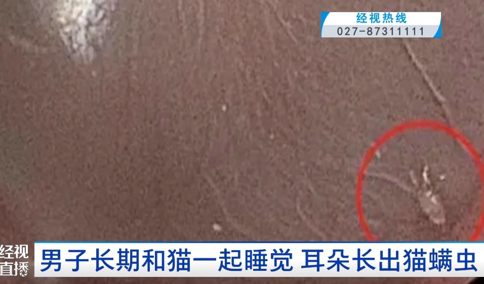 吓人!男子长期和猫一起睡觉,耳朵长出猫螨虫 吓人!男子长期和猫一起睡觉,耳朵长出猫螨虫