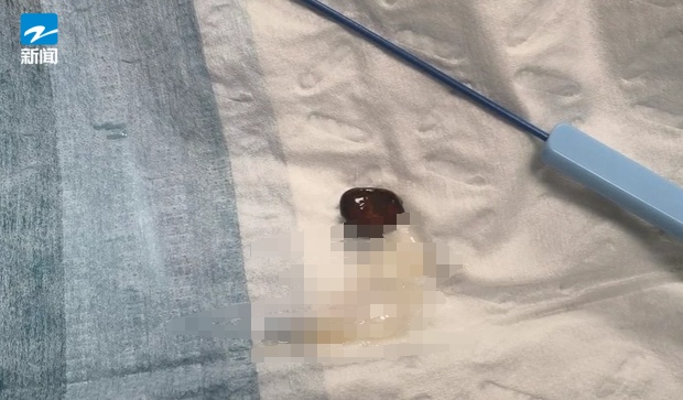 正大量上市！有人因为吃它进了ICU…医生：这种情况千万别不当回事