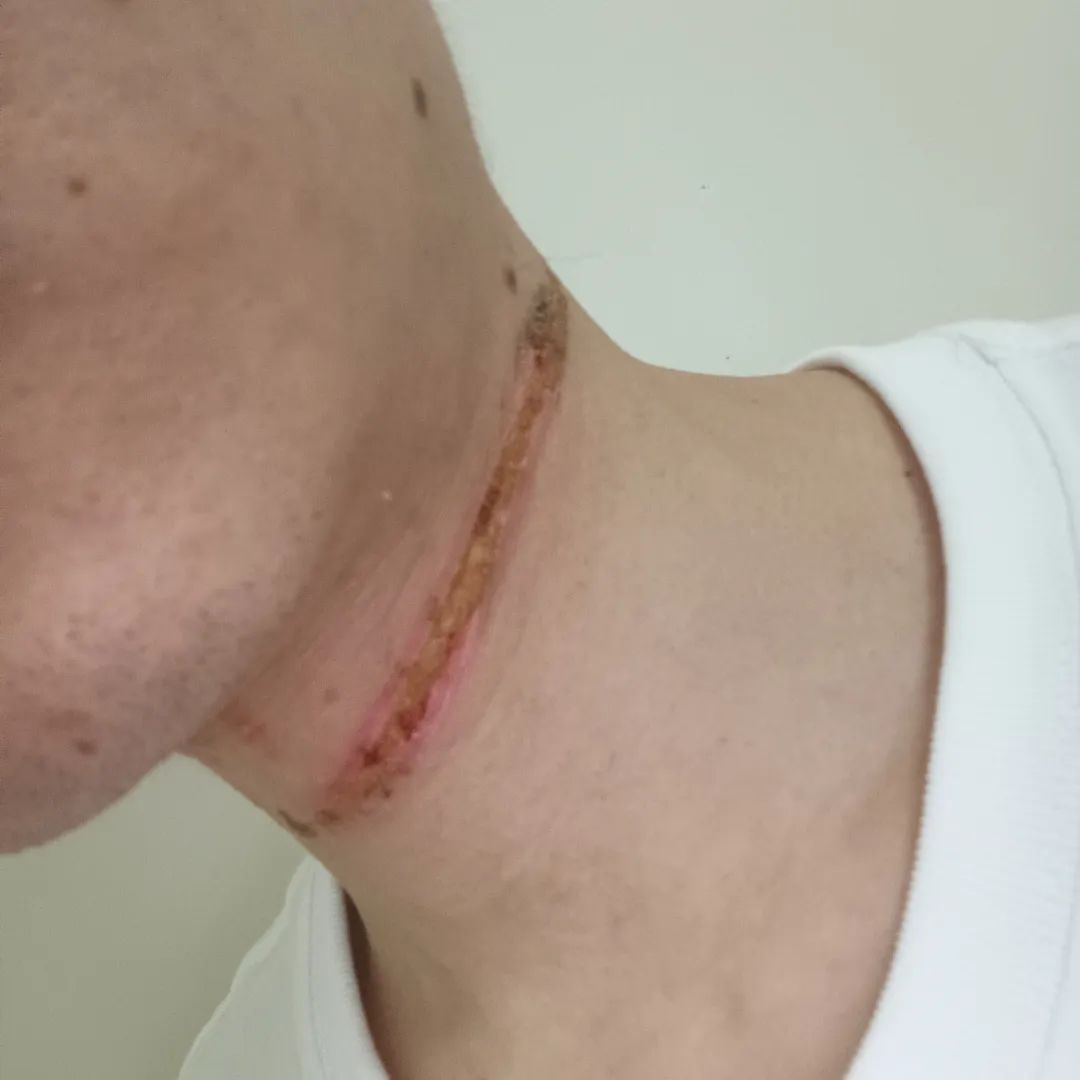 “人差点没了,已报警!”男子骑行中遭风筝线勒喉,如何维权?律师提醒 “人差点没了,已报警!”男子骑行中遭风筝线勒喉,如何维权?律师提醒