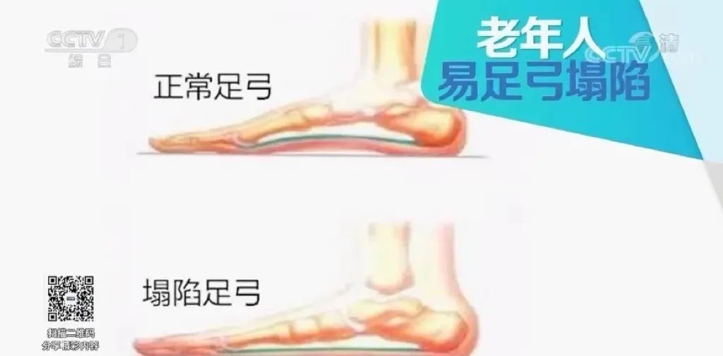 鞋子选不对伤膝伤脚伤关节，这5种鞋以后少穿！