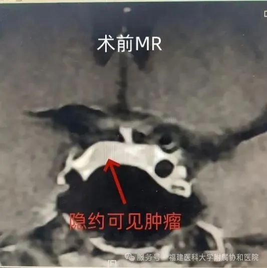 减肥一年，福州男子增重30公斤！原因万万没想到！