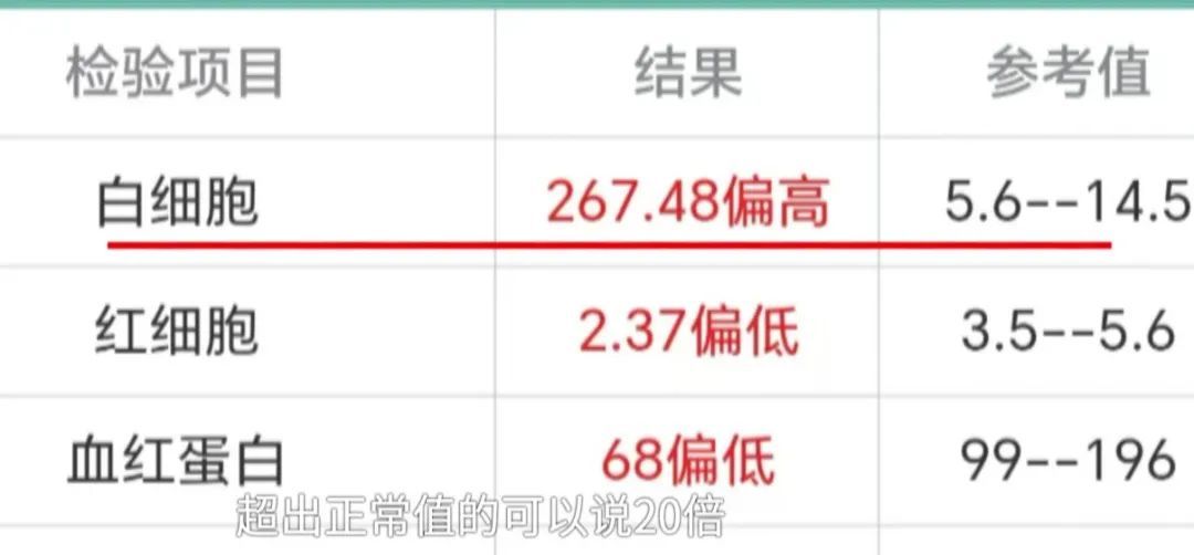 87天男婴身上突长紫斑,确诊急性髓系白血病!医生:可能和这些因素有关 87天男婴身上突长紫斑,确诊急性髓系白血病!医生:可能和这些因素有关