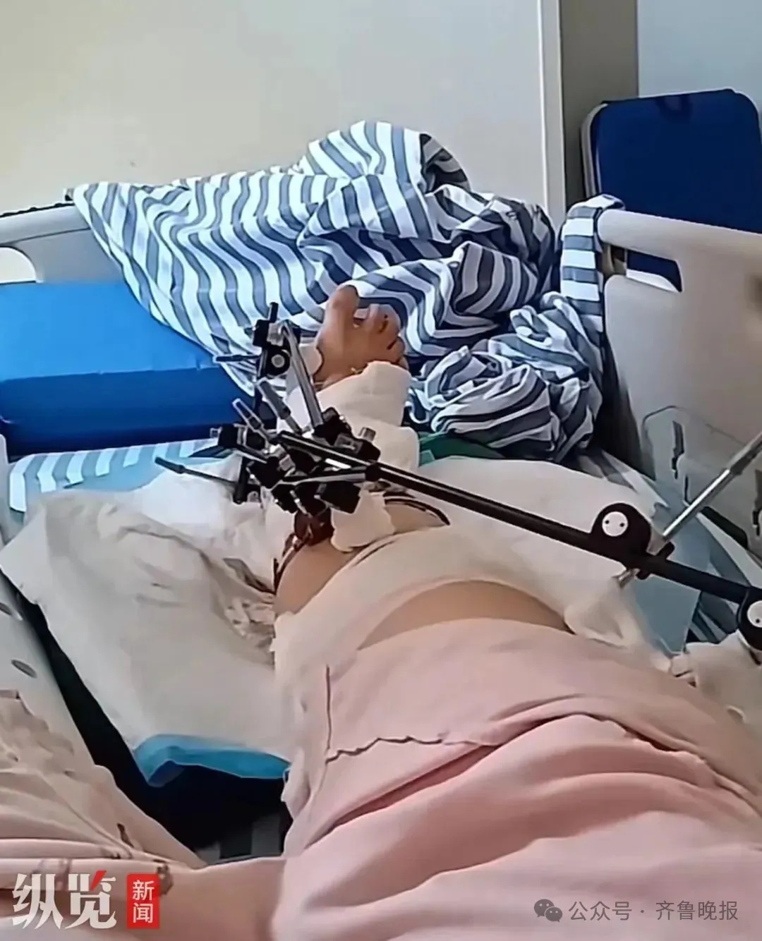 女子从12楼坠落!当事人落地后努力冲老公喊:我还没死,快打120 女子从12楼坠落!当事人落地后努力冲老公喊:我还没死,快打120