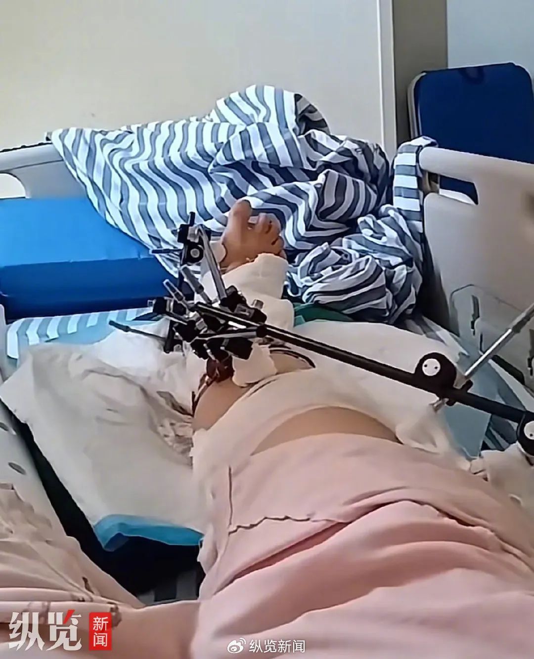 江西一女子从12楼不慎坠落奇迹生还，当事人讲述更多细节