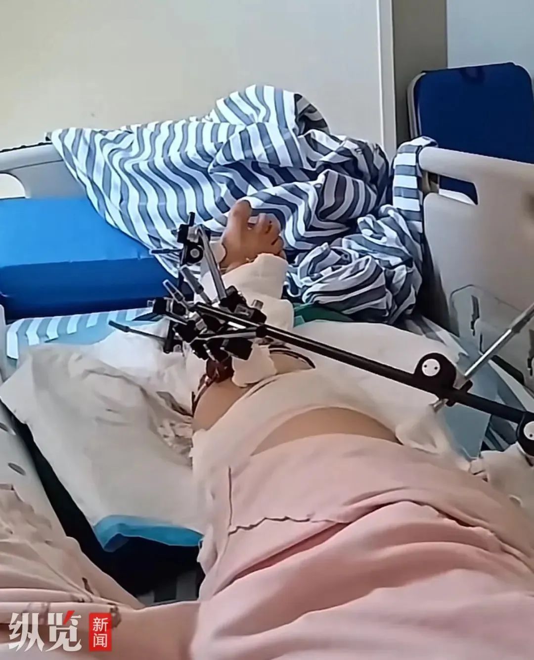 12楼坠落奇迹生还！女子讲述惊险瞬间