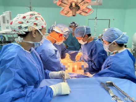 九旬老人腹部胀如西瓜抽出18斤囊液 九旬老人腹部胀如西瓜抽出18斤囊液