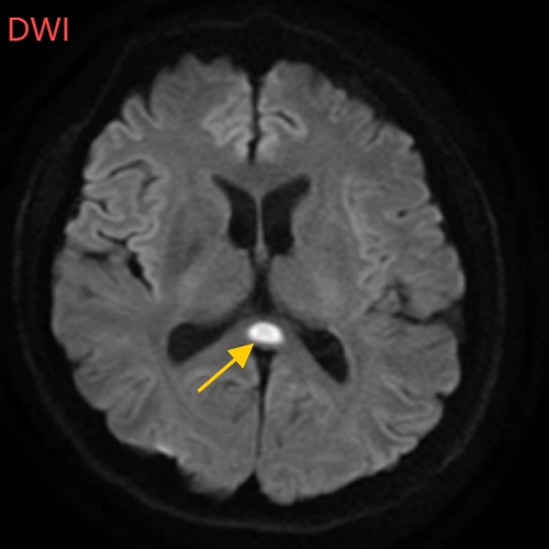 连续15天熬夜+喝酒，35岁设计师差点把脑子喝“坏”了！