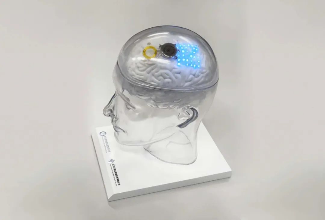 全国首个,价格落地!脑机接口走向临床还有多远 全国首个,价格落地!脑机接口走向临床还有多远