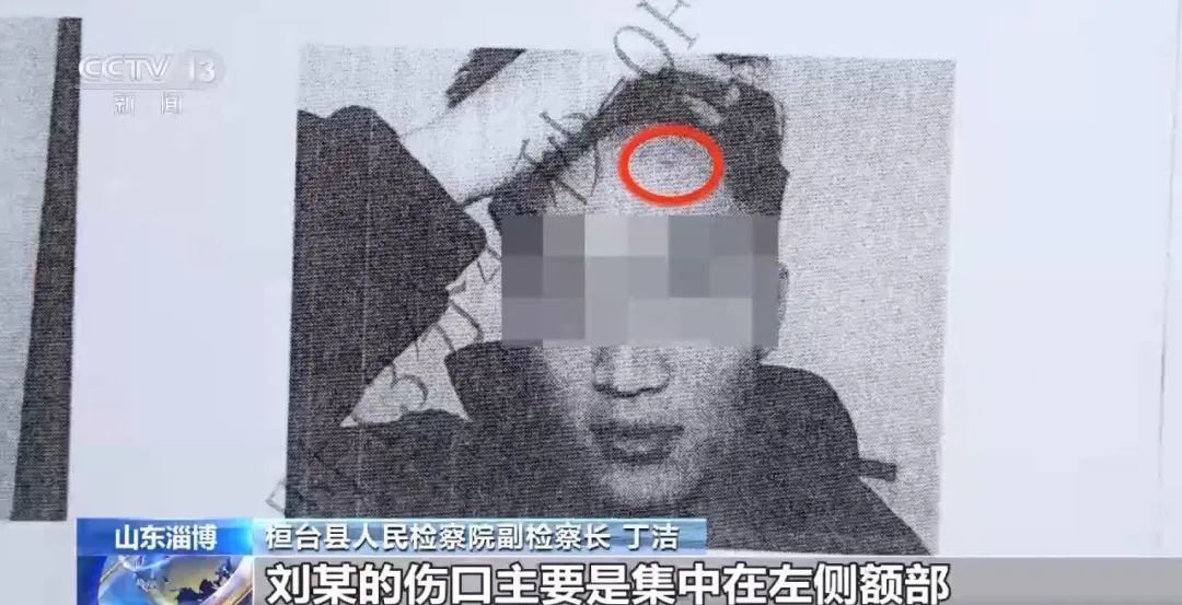 饭店女老板被醉酒顾客打后还手，被定性为互殴！检察官发现关键细节，案件改判