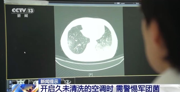 吹了几天空调 左肺“白”了一半！咋回事？