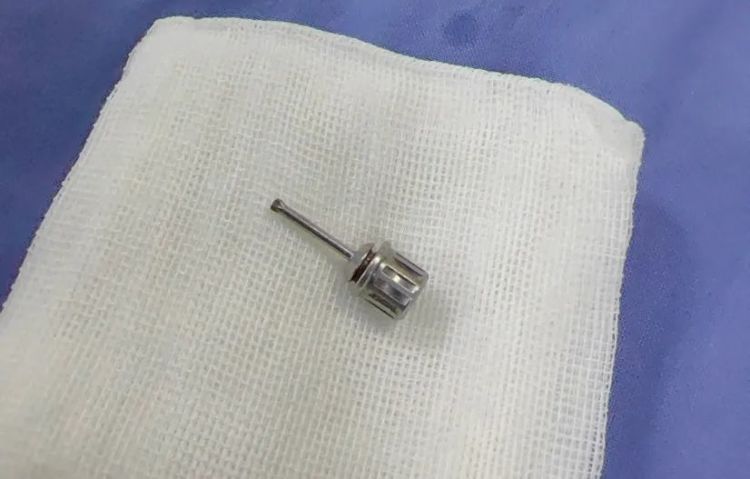 近期高发！七旬老人吃枇杷，核卡喉9天！紧急提醒：吃饭时这个动作最危险