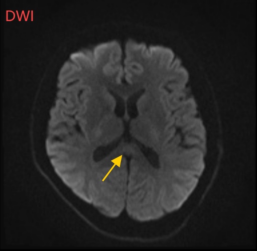 连续15天这么做，35岁男子脑子"坏"了！很多人都好这一口…