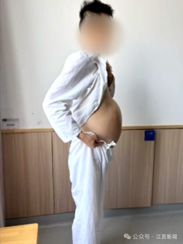 男子4个月没大便，肚子如怀胎十月，医生提醒！