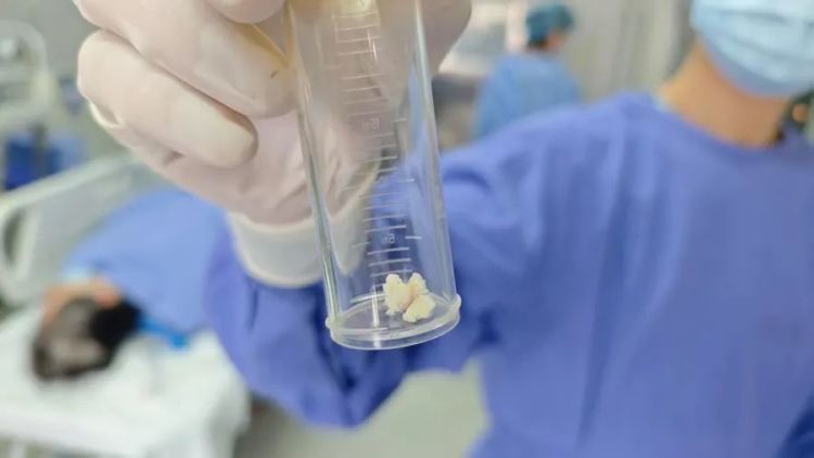 近期高发！七旬老人吃枇杷，核卡喉9天！紧急提醒：吃饭时这个动作最危险