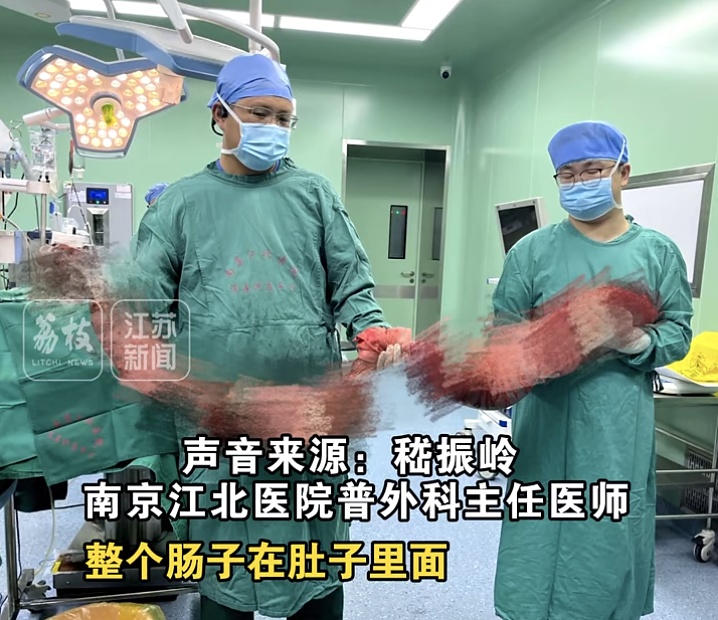 男子整整4个月没大便，腹部如怀胎10月！医生掏出2米长"巨蟒"…